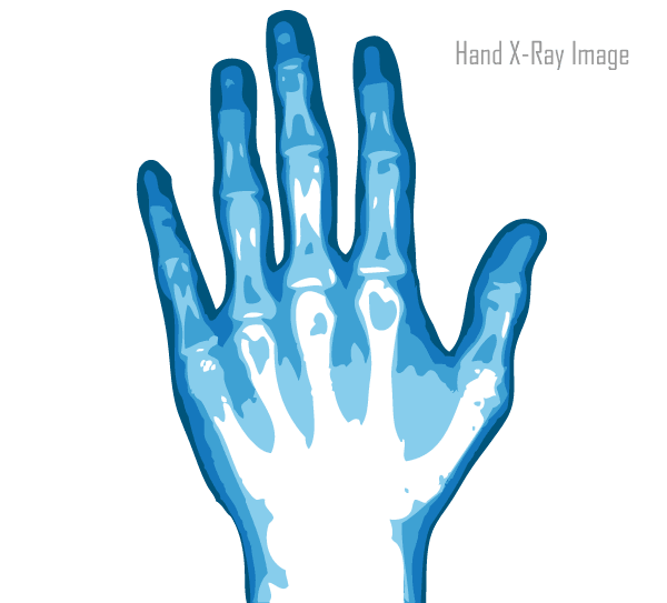 Free Vector X-Ray Hand Image